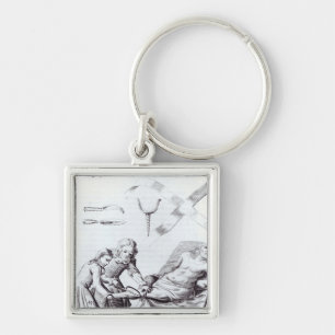 Chirurgische Operation, zum eines Beines zu Schlüsselanhänger