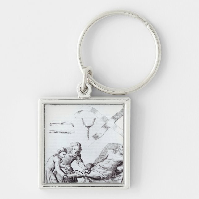 Chirurgische Operation, zum eines Beines zu Schlüsselanhänger (Vorne)