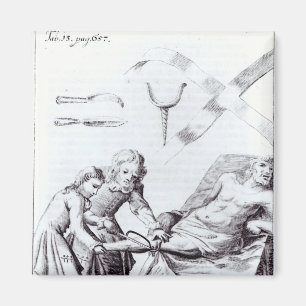 Chirurgische Operation zur Amputation eines Beins Magnet