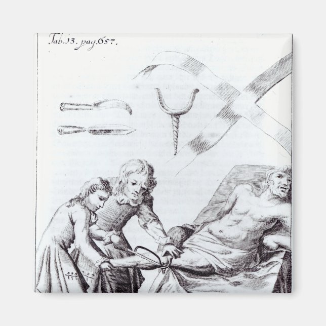 Chirurgische Operation zur Amputation eines Beins Magnet (Vorne)