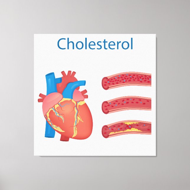 Cholesterin Leinwanddruck (Vorderseite)