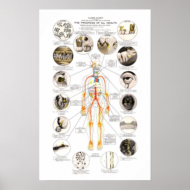 Clark Dental Health Chart für Zahnärzte Poster (Vorne)