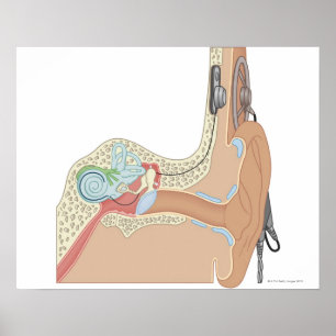 Cochlear Implantate Poster