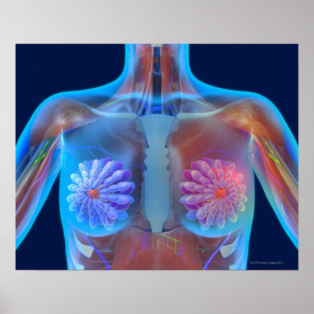 Computerdarstellung, die Brustkrebs repräsentiert, Poster (Vorne)