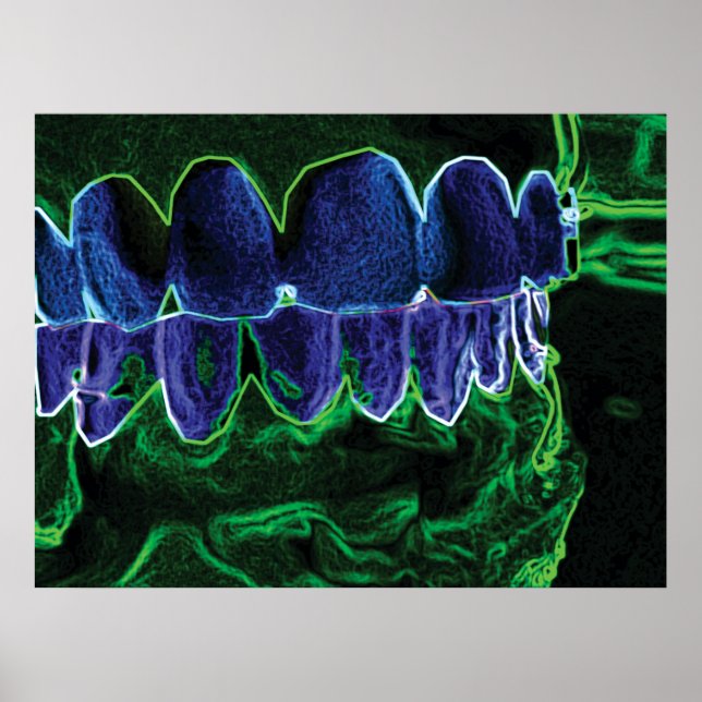 Cool Zähne Modell Zahnarzt Orthodontist Poster (Vorne)