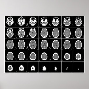 CT SCAN des KOPFES Poster