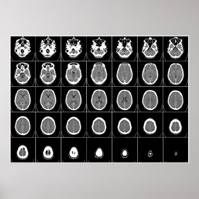 CT SCAN des KOPFES Poster (Vorne)