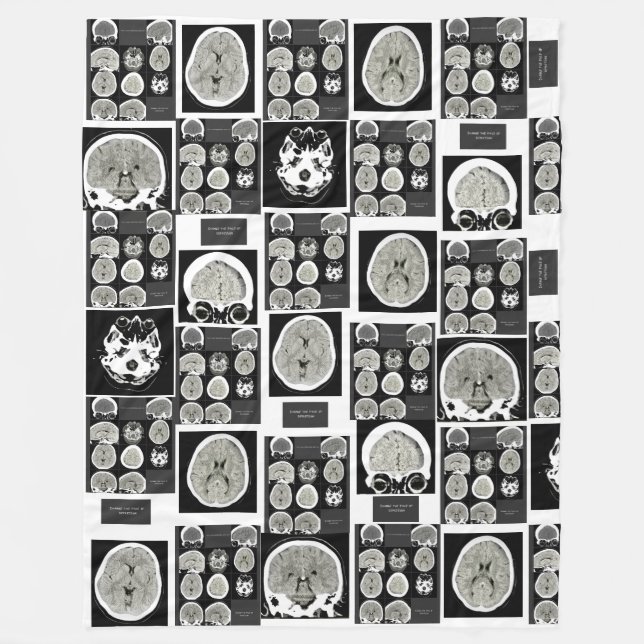 CT Scan_this is depression_CTFOD Fleecedecke (Vorderseite)