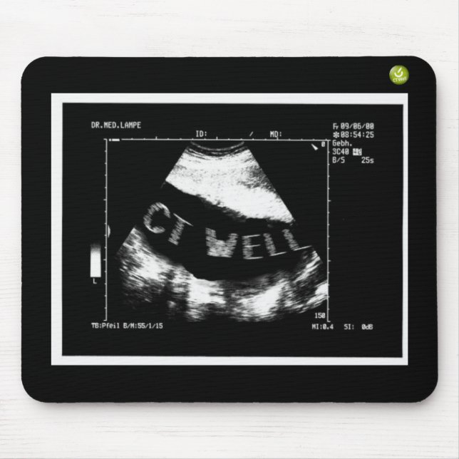 CT Well Mousepade  (CT Well im Bauch) Mousepad (Vorne)