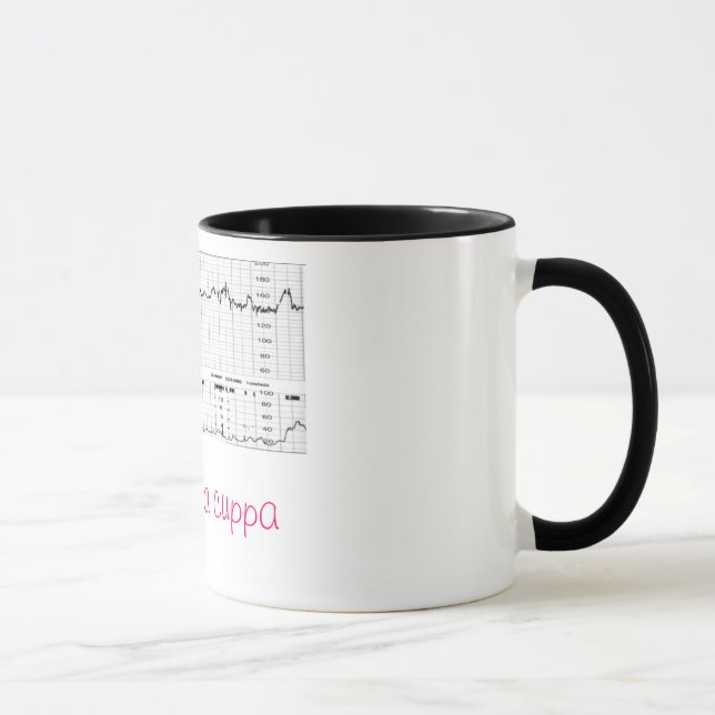 CTG Tasse (Rechts)