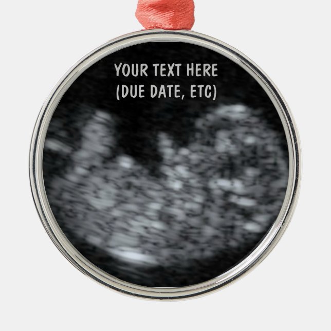 Custom Baby Ultrasound Foto Ornament Aus Metall (Vorne)