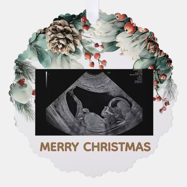 Custom First Christmas Expecting Photo Ornament (Vorderseite)
