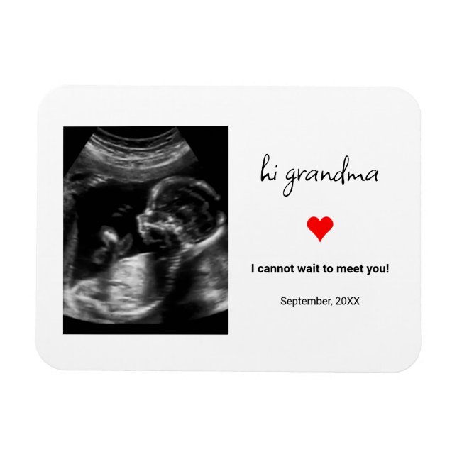 Custom Ultrasound Foto Geschenk für Oma, Opa Magnet (Horizontal)