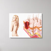 Darstellung eines atypischen Hautwachstums