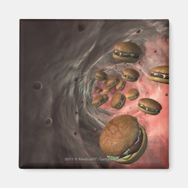 Darstellung eines Blutgefäßes mit Burgern Magnet (Vorne)