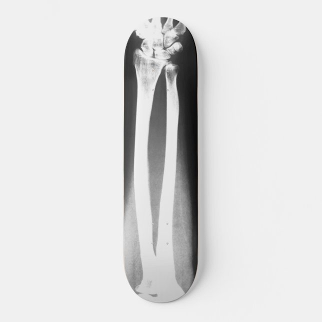 Das Breaks-Skateboard von Bradley Boness Skateboard (Vorderseite)