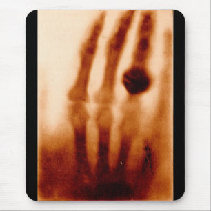 Das erste Röntgenbild, 1901, Fotografie Mousepad