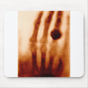Das erste Röntgenbild, 1901, Fotografie Mousepad
