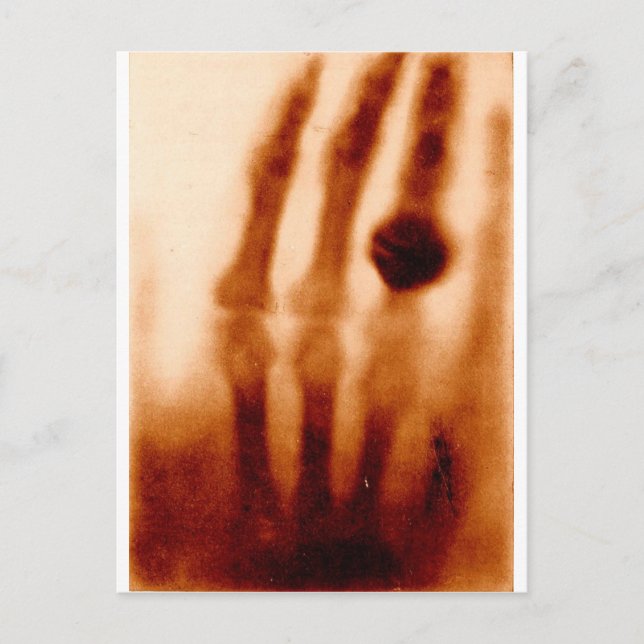 Das erste X-Ray, 1901, Foto Postkarte (Vorderseite)