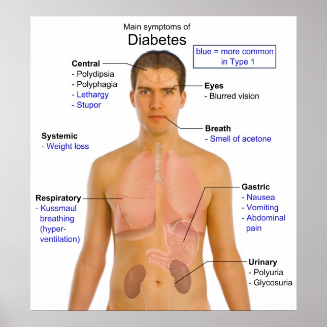Diagramm der Hauptsymptome des Diabetes beim Mensc Poster (Vorne)