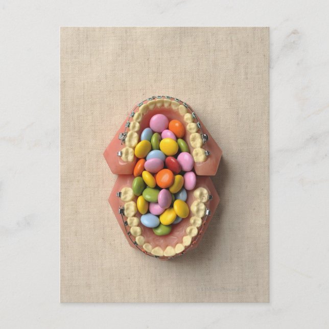 Die im Zahnmodell servierte Schokolade Postkarte (Vorderseite)