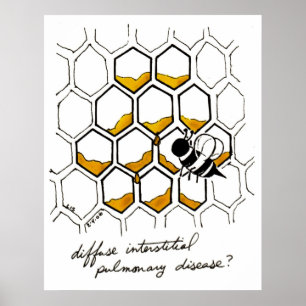 Diffuse interstitielle Lungenerkrankung Poster