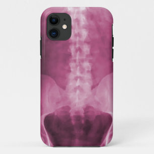 Digital-Röntgenstrahl-Kunst iPhone 5 Fall Case-Mate iPhone Hülle