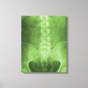 Digital X-Ray Art Wrapped Canvas Leinwanddruck