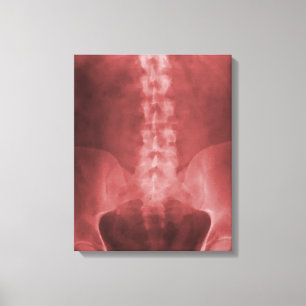 Digital X-Ray Art Wrapped Canvas Leinwanddruck