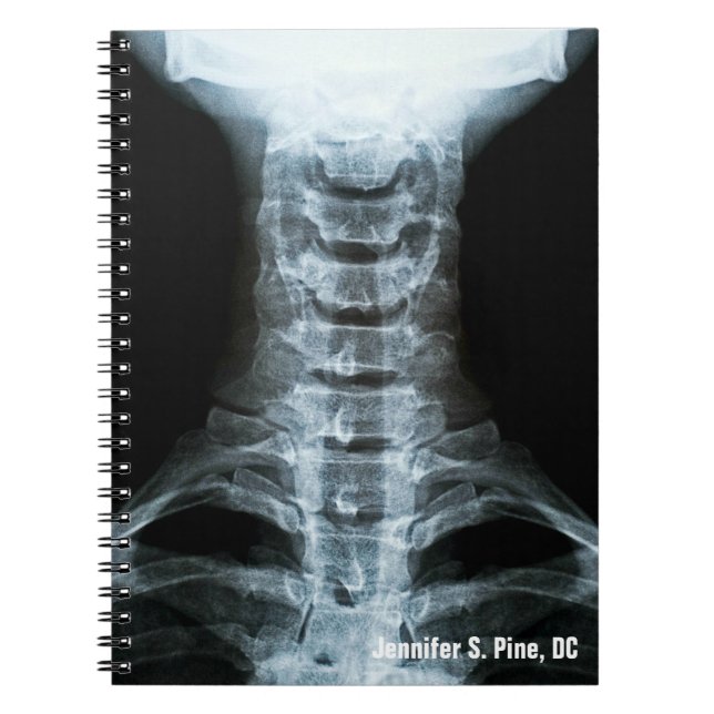Digitales X-Ray-Personalisiert-Notebook Notizblock (Vorderseite)