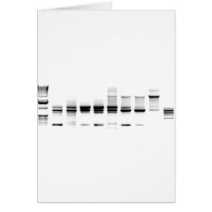 DNA Gel