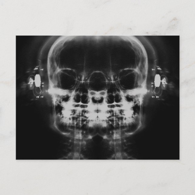 Doppel-X-Ray-Skulls mit Kopfhörern - B&W Postkarte (Vorderseite)