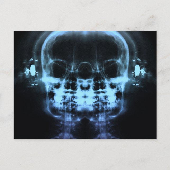 Doppel-X-Ray-Skulls mit Kopfhörern - Blau Postkarte (Vorderseite)