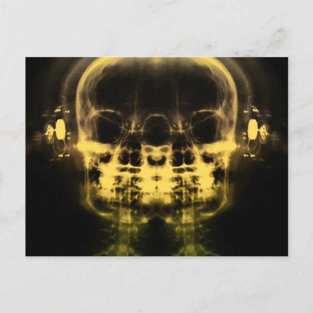 Doppel-X-Ray-Skulls mit Kopfhörern - Gelb Postkarte (Vorderseite)