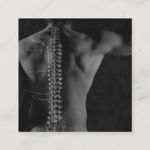 Dorn, der Überlagerungs-Foto-Chiropraktik zeichnet Quadratische Visitenkarte