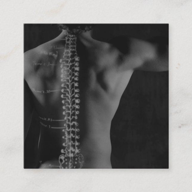 Dorn, der Überlagerungs-Foto-Chiropraktik zeichnet Quadratische Visitenkarte (Vorderseite)