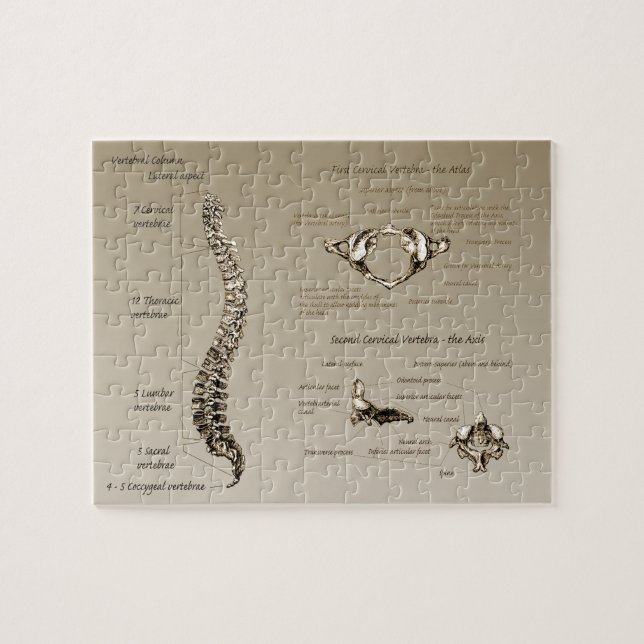 Dorn Puzzle (Horizontal)