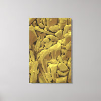 Doxycyclin gehört zum Tetracyclin-Antibi