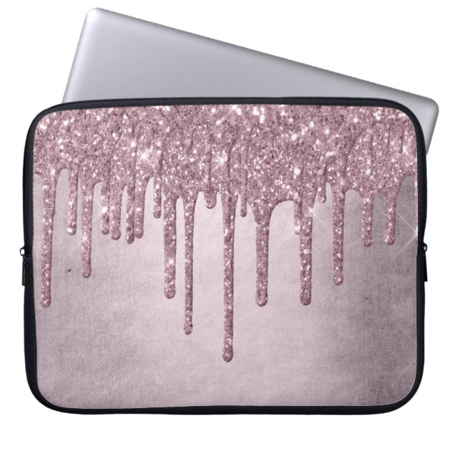 Drilling Girly Glitzer | Dusty Mauve Pink Shimmer Laptopschutzhülle (Vorderseite)