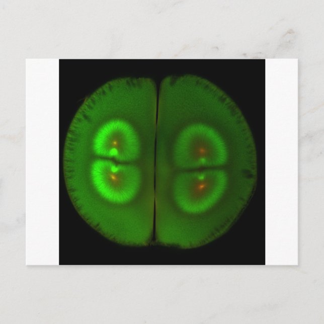 Düngefroschei Postkarte (Vorderseite)