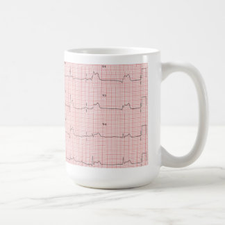 ECG Tasse