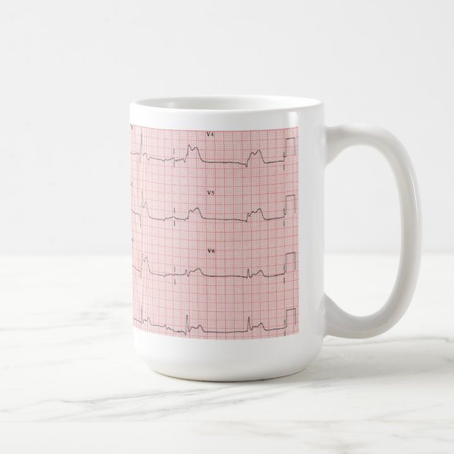ECG Tasse (Rechts)