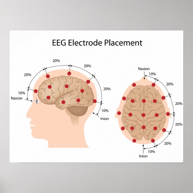 EEG-Elektrodenplatzierungs-Diagramm Poster (Vorne)