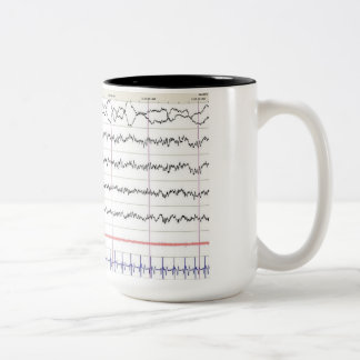 EEG Tasse - Rem-Schlaf