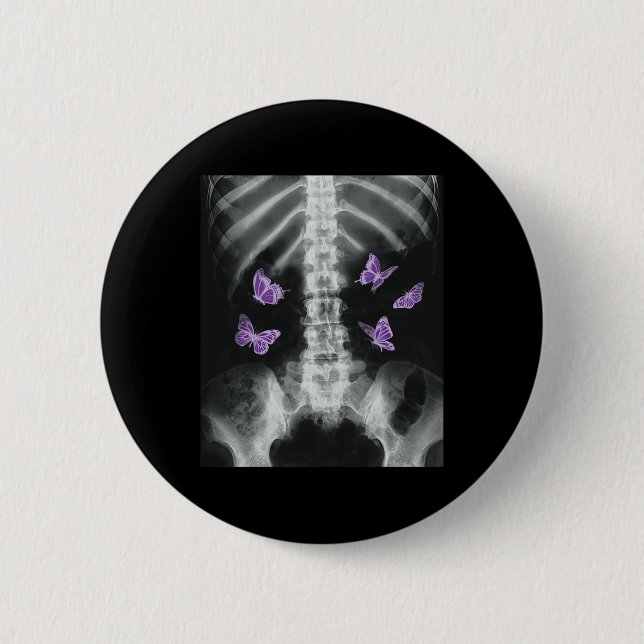 Egirl Xray Skeleton Pink Butterfly Harajuku Y2k Da Button (Vorderseite)