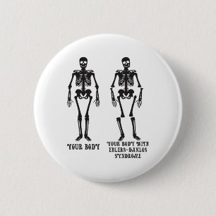 Ehlers - Ihr Körper mit dem Ehlers Danlos Syndrom  Button