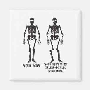Ehlers - Ihr Körper mit dem Ehlers Danlos Syndrom Magnet