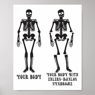 Ehlers - Ihr Körper mit dem Ehlers Danlos Syndrom  Poster