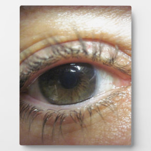Ein anderes Auge Fotoplatte
