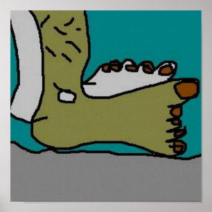 Ein sonnenverbrannter Fuß Poster